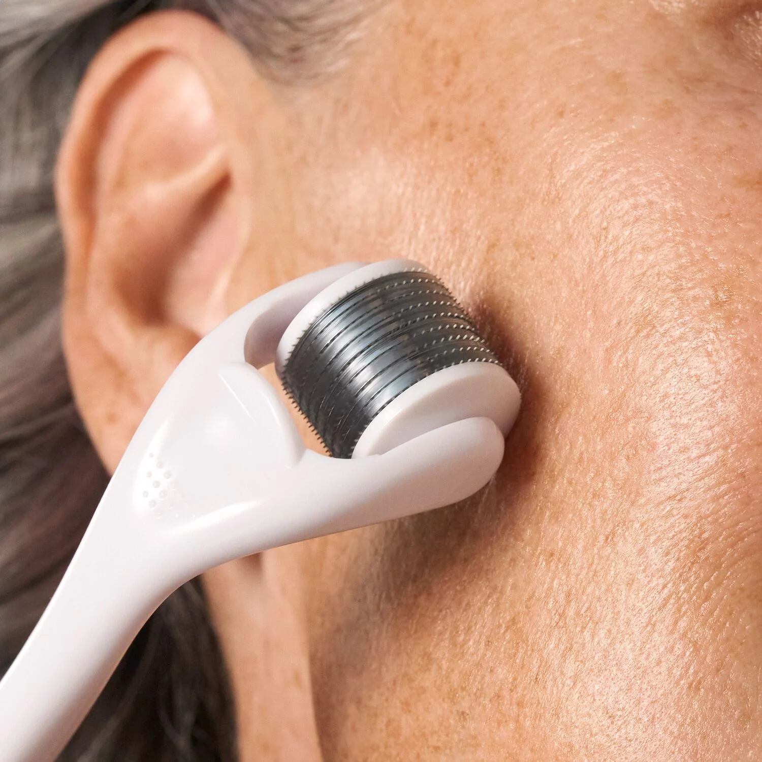 Slowpoke Microneedling Facial Roller - Image 5